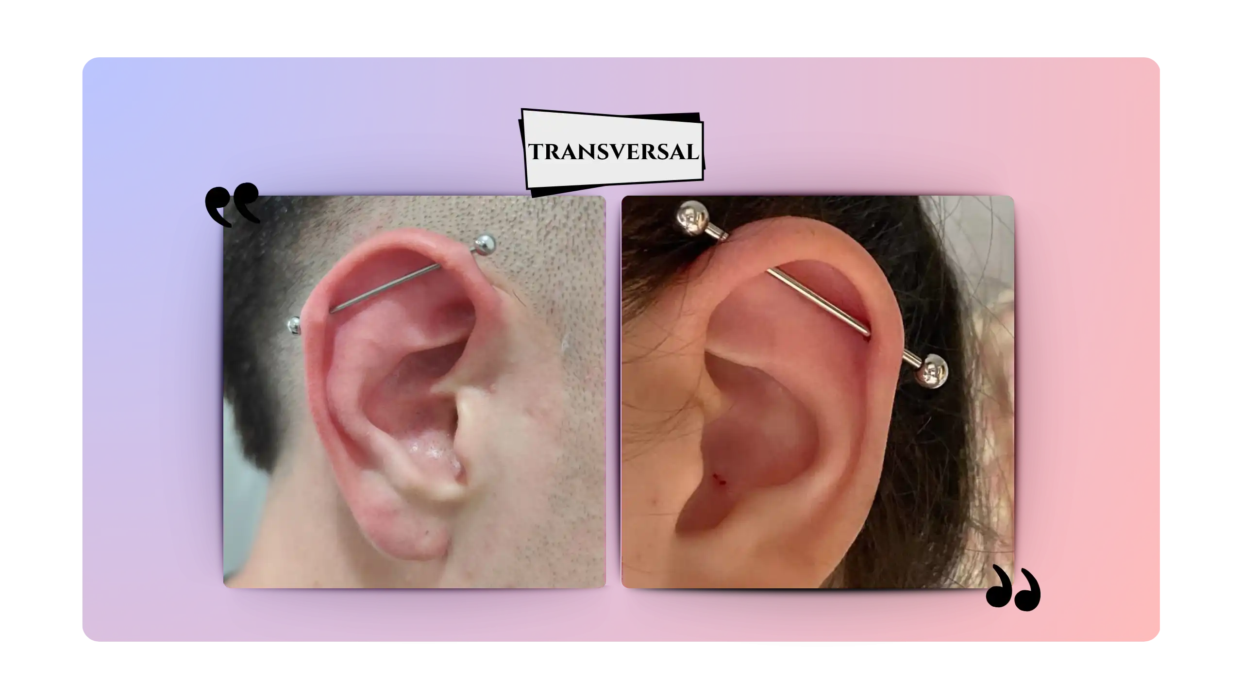 Transvversal